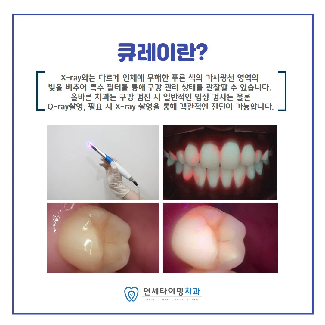 큐레이 촬영 원리와 활용 안내